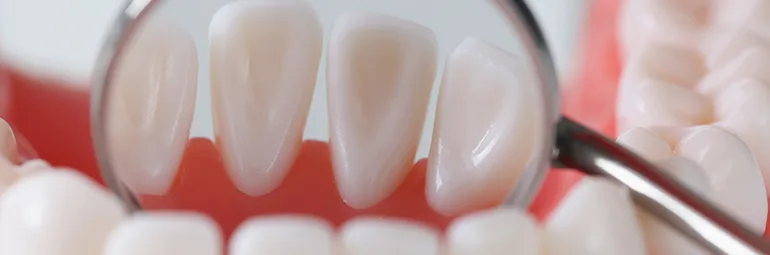 Teeth Plaque Removal