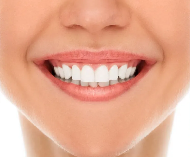 Tooth Whitening at Home