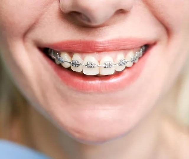 Ortodonti Uygulamaları