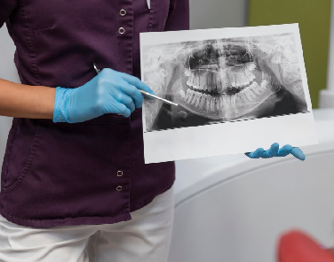 dental-x-ray